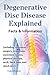 Degenerative Disc Disease Explained by Frederick Earlstein