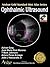 Ophthalmic Ultrasound (Anshan Gold Standard Mini Atlas)