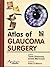 Atlas of Glaucoma Surgery