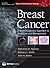 Breast Cancer: A Multidisciplinary Approach to Diagnosis and Management (Current Multidisciplinary Oncology)