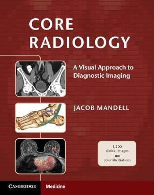 Core Radiology: A Visual Approach to Diagnostic Imaging