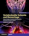 Vertebrobasilar Ischemia and Hemorrhage: Clinical Findings, Diagnosis and Management of Posterior Circulation Disease