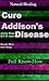 Natural Healing - Cure Addison's Disease. Full Know-How.