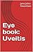 Eye book: Uveitis (Few Facts About The Eye Book 2)