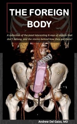 The Foreign Body: A collection of the most interesting X-rays of things that don’t belong and the stories behind how they got there! (Kindle Edition)