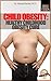 Child Obesity: Healthy Chil...