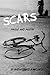 Scars