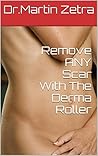 Remove ANY Scar W...