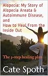 ALOPECIA: MY STOR...