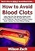 How to Avoid Blood Clots: Learn How You Can Quickly & Easily Avoid Getting Blood Clots The Right Way Even If You’re a Beginner, This New & Simple to Follow Guide Teaches You How Without Failing