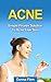 Acne: Simple Proven Solutio...