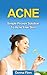 Acne: Simple Proven Solution To Acne Free Skin: How To Cure Acne For Good And Achieve Lasting Acne Freedom (Acne Cure, Acne No More, Acne Diet, Clear Skin, ... Free Skin, Get Rid Of Acne, Acne Treatment)