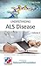 UNDERSTANDING Amyotrophic Lateral Sclerosis (ALS) Disease | Signs, Symptoms, Treatment & Prevention: A Quick Guide to ALS Disease