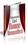 Sebaceous Cysts Home Remedies