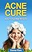 Acne Cure: How To Get Rid Of Acne: The Amazing Acne Treatment Secret Of Top Models And Celebrities (Acne Cure, Acne No More, Acne Diet, Acne Scar, Acne ... Guide To Acne Free Skin, Acne Treatment)