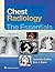 Chest Radiology: The Essent...