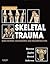 Skeletal Trauma E-Book (Browner, Skeletal Trauma)