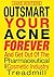 Outsmart Your Acne Forever by Jane Winters Outsmart Your Acne Forever by Jane Winters