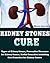 Kidney Stones Cure: Natural Treatments for Kidney Stones, Types of Kidney Stones, Preventive Measures for Kidney Stones, Useful Remedies including Diet Remedies for Kidney Stones