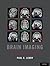 BRAIN IMAGING