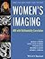 Women's Imaging: MRI with Multimodality Correlation (Current Clinical Imaging)