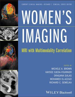 Women's Imaging: MRI with Multimodality Correlation (Current Clinical Imaging)