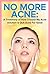 Acne: No More Acne: A Testimony of How I Found My Acne Solution & Quit Acne For Good