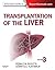 Transplantation of the Liver