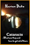 Cataracts: What are they and how to get rid of them? (Your Eyes Book 2)