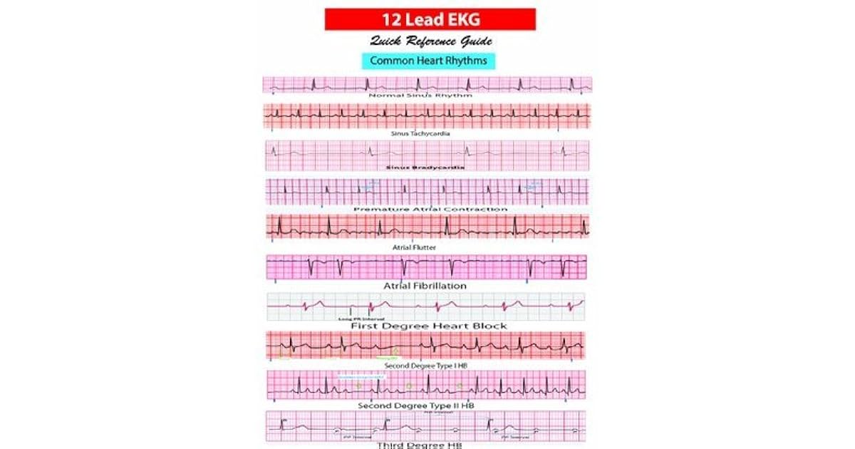 12 Lead EKG Pocket Card by APRN World 12 Lead EKG Pocket Card by APRN World