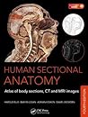 Human Sectional Anatomy by Adrian Kendal Dixon