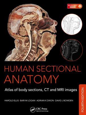 Human Sectional Anatomy: Atlas of Body Sections, CT and MRI Images (Hardcover)