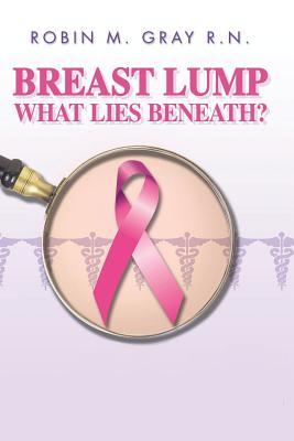 Breast Lump What Lies Beneath?: A Must Read To Help Obtain The Correct Diagnosis and Avoid The Common Pitfalls Of A Doctor Related Breast Cancer Misdiagnosis