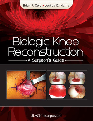 Biologic Knee Reconstruction: A Surgeon's Guide