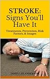 STROKE: Signs You'll Have It: Treatments, Prevention, Risk Factors, & Images