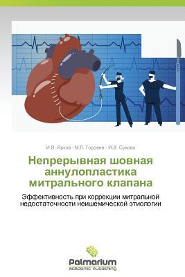 Nepreryvnaya shovnaya annuloplastika mitral'nogo klapana: Effektivnost' pri korrektsii mitral'noy nedostatochnosti neishemicheskoy etiologii (Russian Edition)