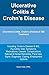 Ulcerative Colitis & Crohn’s Disease. IBS Treatment: Ulcerative Colitis, Crohn's Disease & IBS Treatment Including: Crohn's Disease & IBS, Ayurveda, Diet, Symptoms, Medications, Causes, Complications