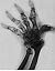 Genes and Disease - Muscle ...