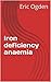 Iron deficiency anaemia
