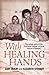 With Healing Hands: The Unt...