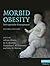 Morbid Obesity: Peri-operative Management (Cambridge Medicine (Hardcover))