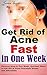 Get Rid of Acne Fast: Remov...