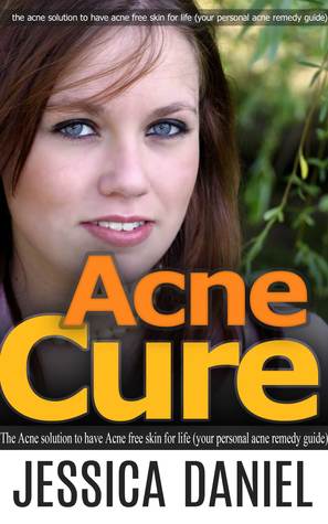 Acne Cure: The Acne Solution to Have Acne Free Skin for Life (Your Personal Acne Remedy Guide) (Self Help Book 5) [Kindle Edition]
