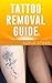Tattoo Removal Guide - How To Remove Your Tattoo For Life (Tattoo Removal, Art Removal)