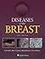 Diseases of the Breast by Jay R. Harris