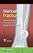 Manual de fracturas (Spanish Edition)