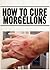 How To Cure Morgellons