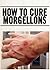 How To Cure Morgellons by Michael Chapala