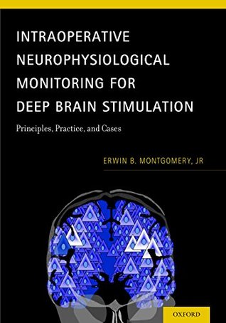 Intraoperative Neurophysiological Monitoring for Deep Brain Stimulation: Principles, Practice and Cases (Kindle Edition)
