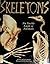 Skeletons by Jinny Johnson